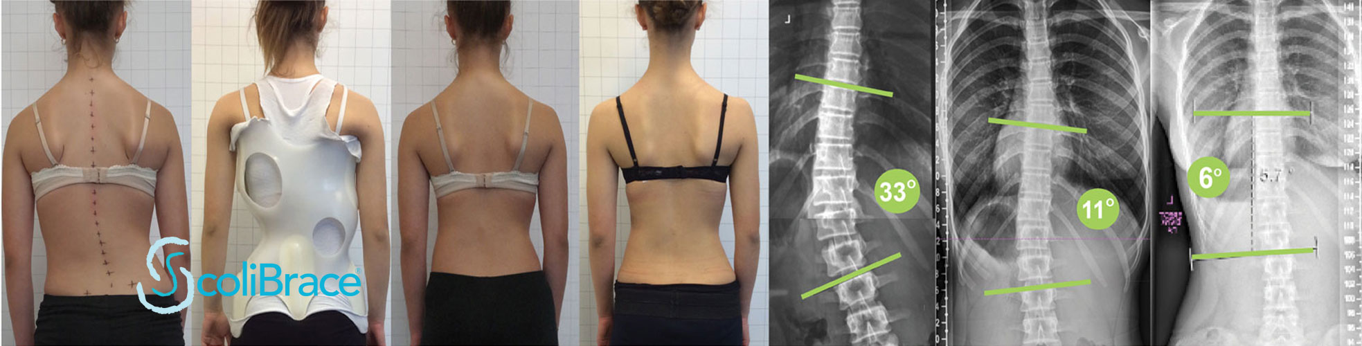 chiropractors and Chiropractic treatment